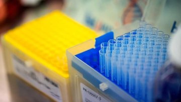 Test tubes in lab setting