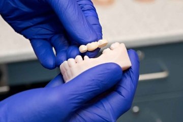 Dental 3D Printing