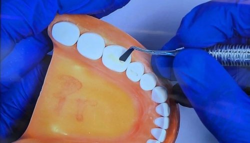 Student uses proper positioning to hold dental implement during tooth exam.