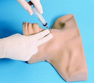 Cricothyrotomy