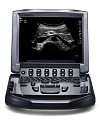 Sonosite Ultrasound